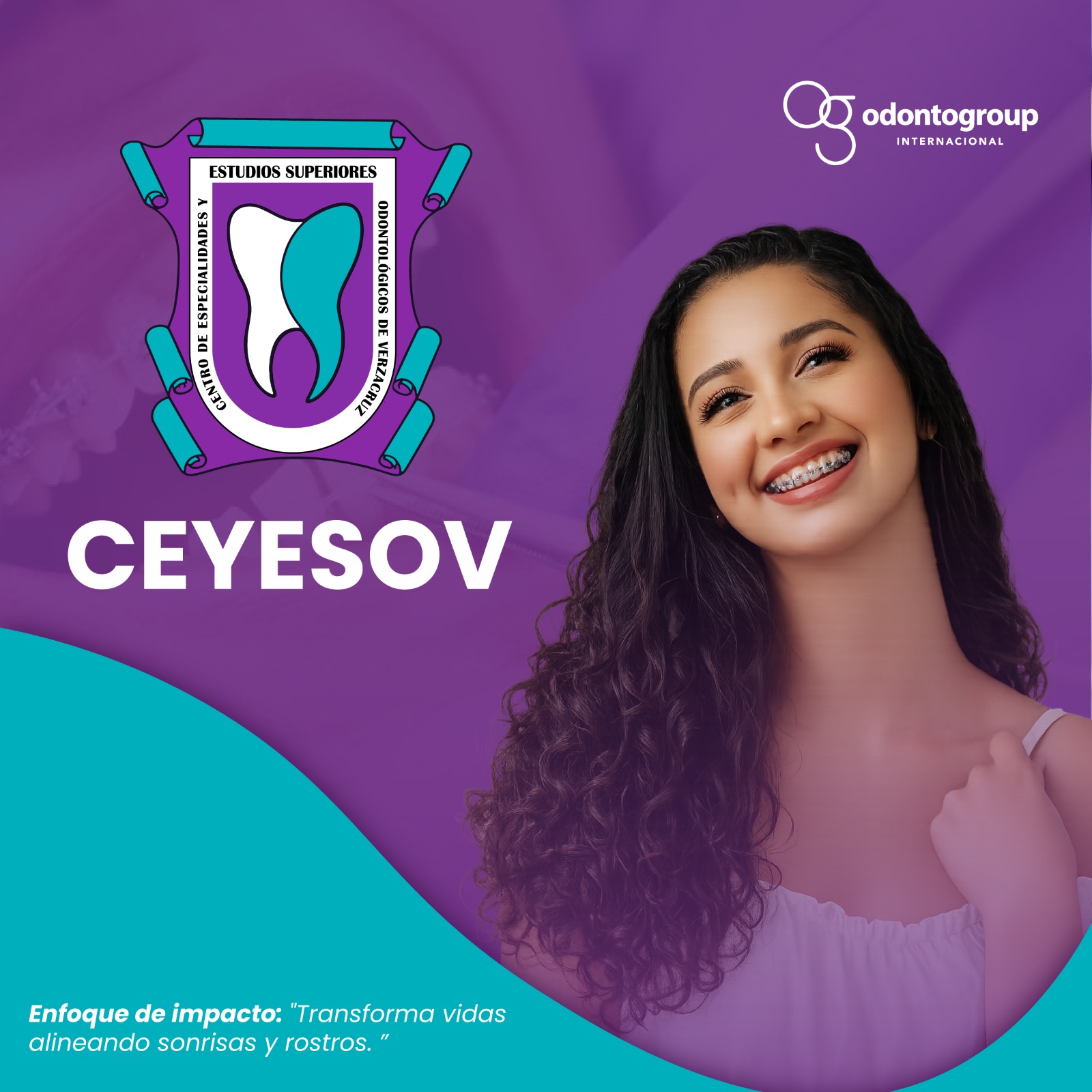 CEYESOV