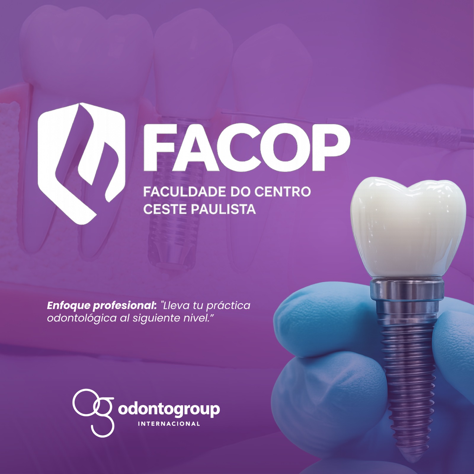 FACOP